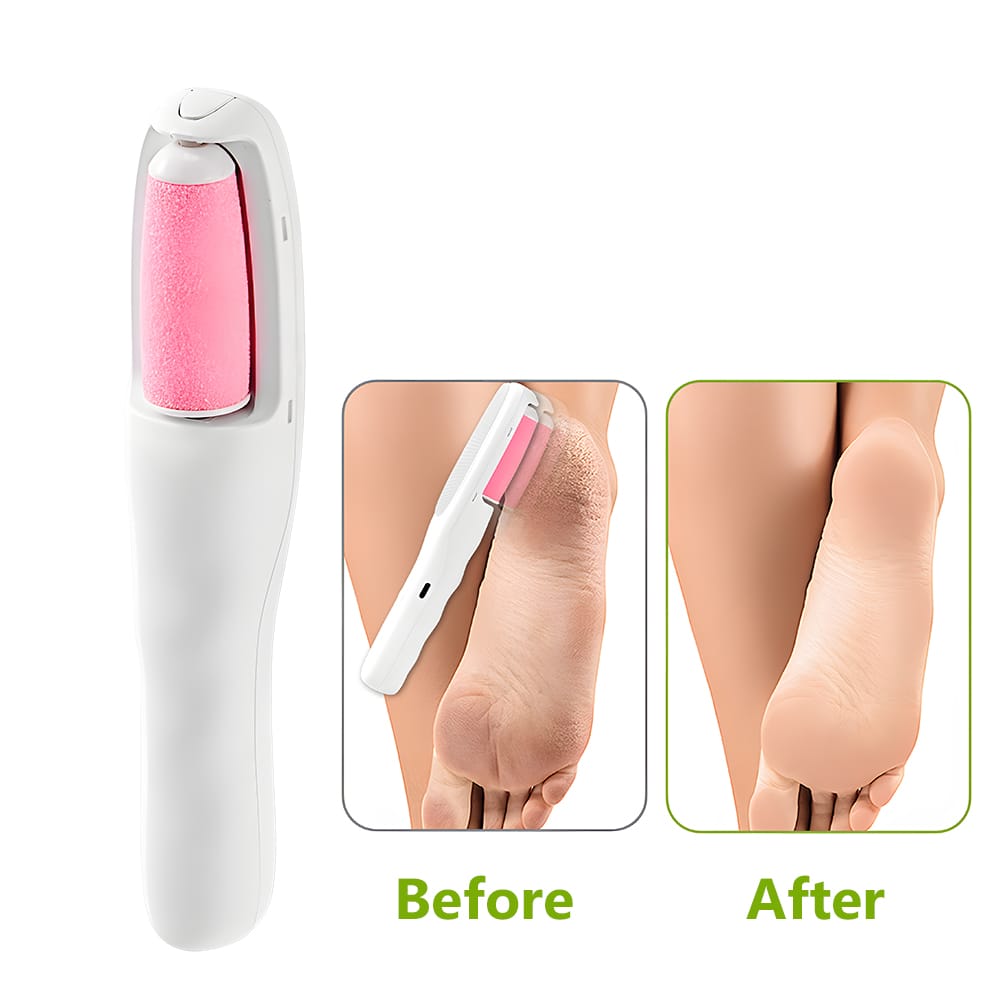 Electric Foot Grinder Hair Remover